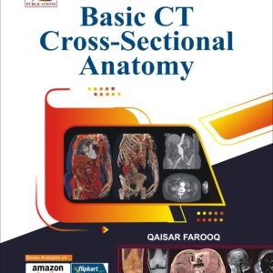 Basic CT Cross-Sectional Anatomy (Coloured)